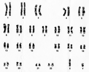 Karyotype (boy)