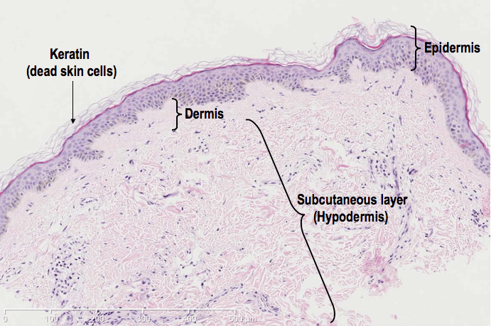 Skin Low Magnification (H&E)
