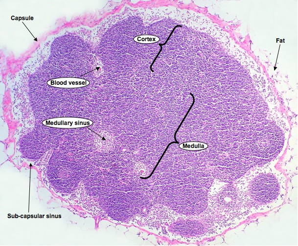 Lymph Node - low magnification (image credit: [click to source] wikicommons, adapted)