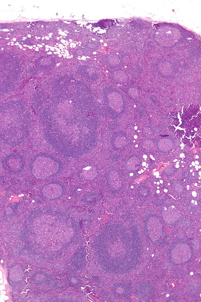 As the B-cells multiply, this process is displayed by the appearance of these roughly circular "follicles".  The paler central zones are known as germinal centers.