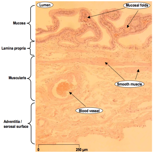 A H&E section showing the full thickness of a gallbladder wall.