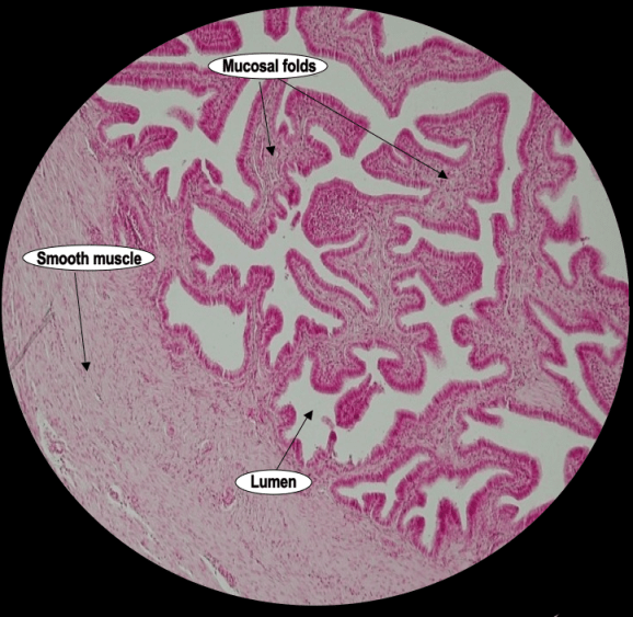An image showing a medium power Haematoxylin & Eosin  stained section of the ampulla region of the fallopian tube