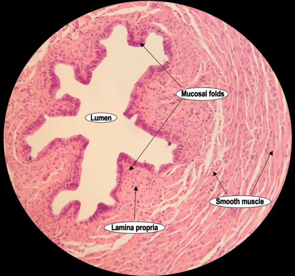 An image showing a medium power Haematoxylin & Eosin stained section of the isthmus region of the human fallopian tube