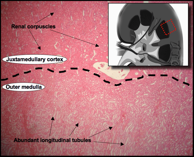 An image showing the renal cortex and medulla