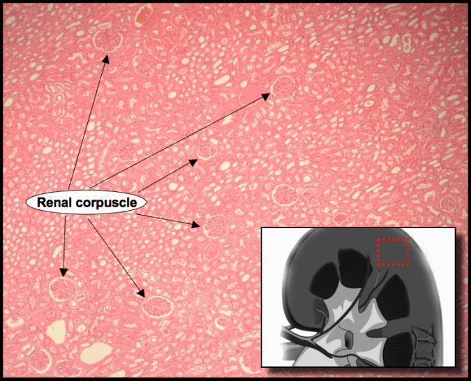 An image showing the Cortex Region with renal corpuscles