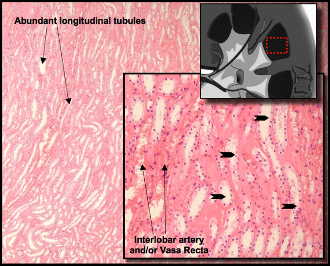 An image showing the tubules of the renal medulla