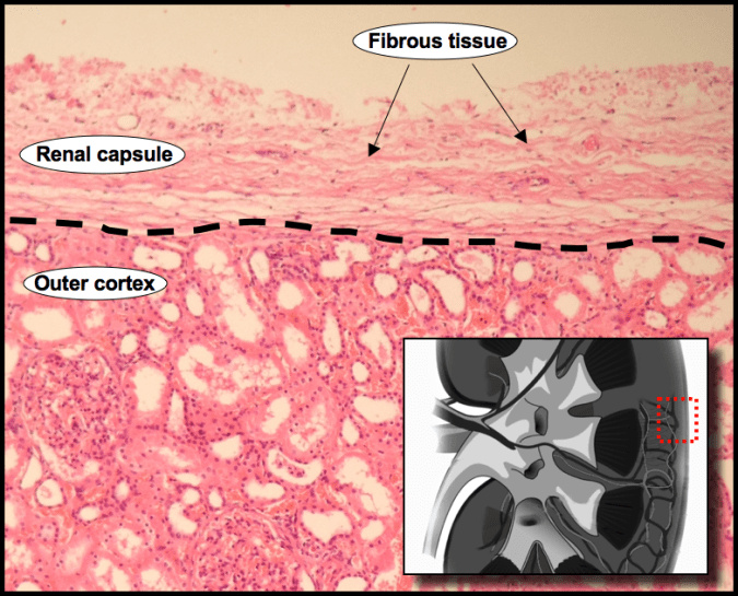 An image showing the renal capsule and its relation to the cortex.