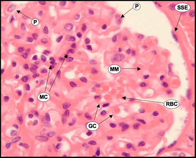 An image showing a high magnification of a Renal Corpuscle