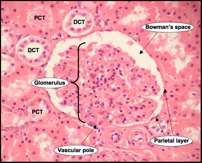 An image showing a medium magnification of a Renal Corpuscle