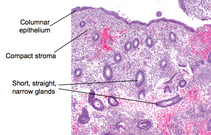 Proliferative endometrium_m2t