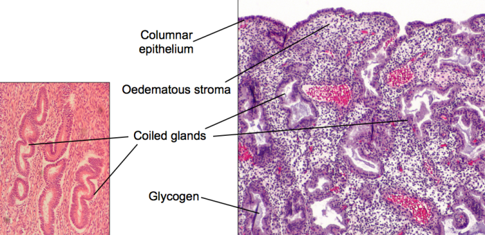 Secretory endometrium_m2t