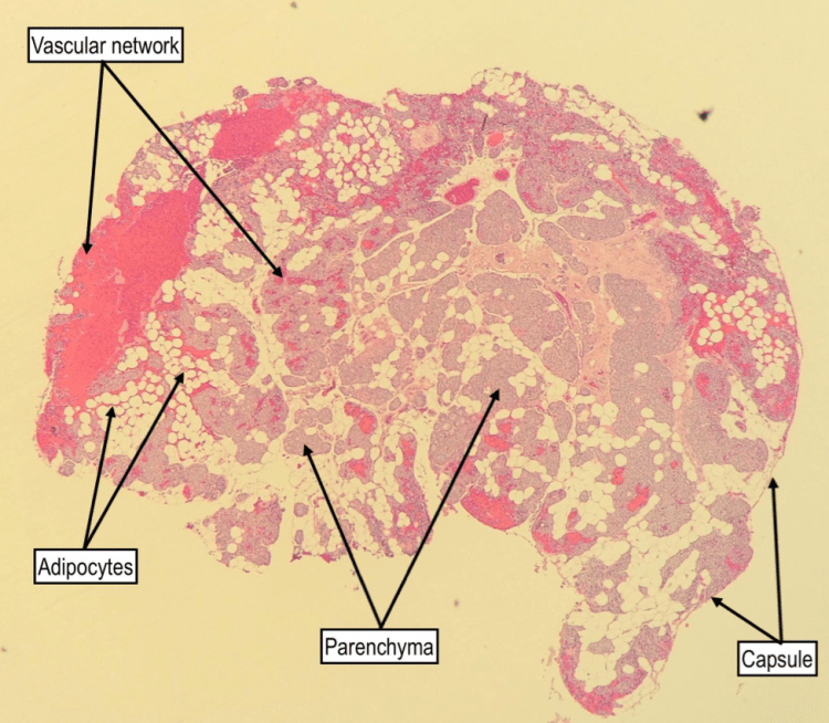 A low power H&E of a parathyroid gland