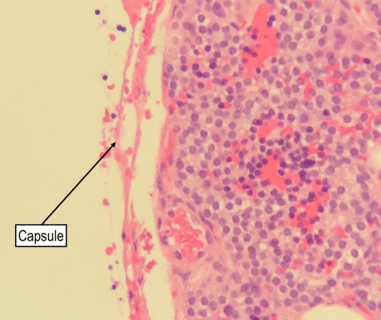 A medium power H&E demonstrating the thin fibrous capsule that surrounds the parathyroid gland
